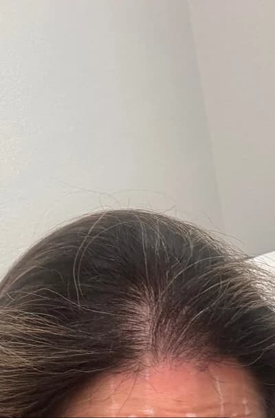 After Hair, follow-up