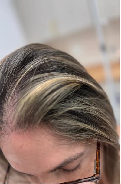 Before Hair