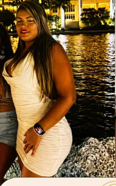 Before Weight Loss